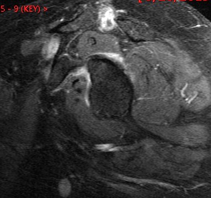 Figure 5 for case Gout ( RID3567 )